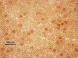 4 - Cellule corticali e tetrasporocisti in visione superficiale